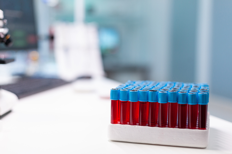 medical-vacutainer-with-blood-sample-standing-table-pharmaceutical-examination.jpg